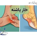 درمان غیرجراحی خارپاشنه