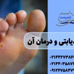 پای دیابتی علت و راه درمان آن | کلینیک تندرست