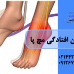 درمان افتادگی مچ پا (علائم + درمان)