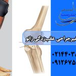 علت عقب‌زدگی زانو (در کودکان و بزرگسالان) + درمان با ورزش