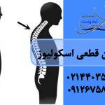درمان قطعی اسکولیوز